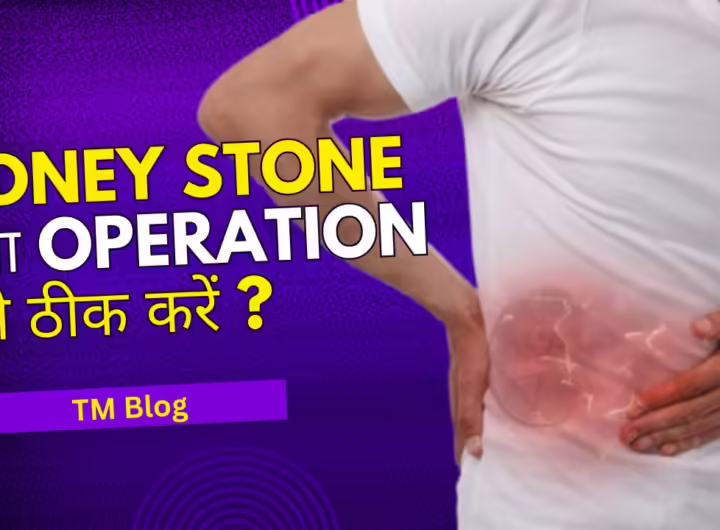 Kidney Stone को बिना Operation कैसे ठीक करें ?